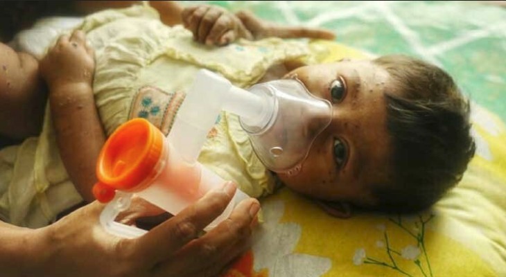 হামের লক্ষণ শুরু হলে করণীয় কী?